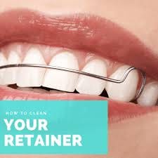 Everything You Need to Know About Ceramic Braces