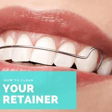 Everything You Need to Know About Ceramic Braces