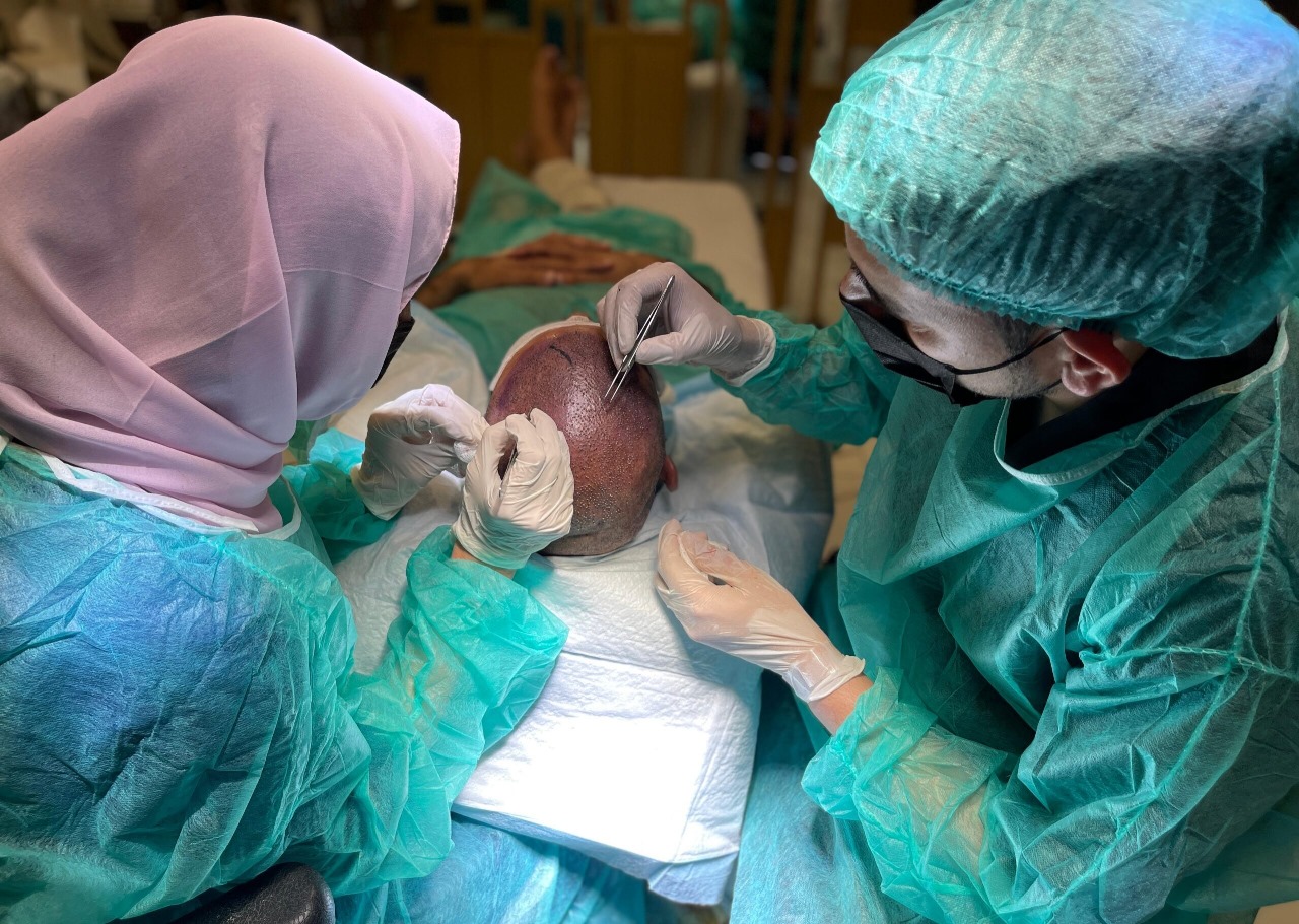 Hair Transplant London Specialists – The Science Behind Our Success